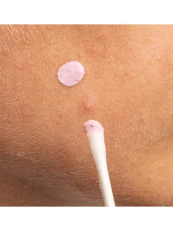 Goodbye Blemish Pink Spot